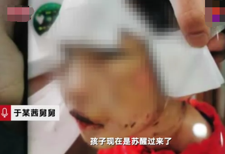 黑龙江遭虐打女童已出院 究竟是怎么回事？