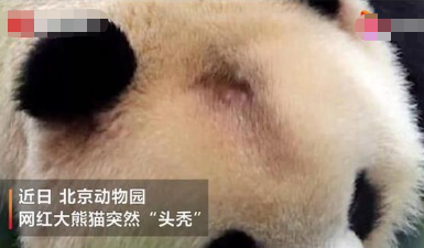 北京网红大熊猫突然“头秃” 头秃原因实在让人惊讶