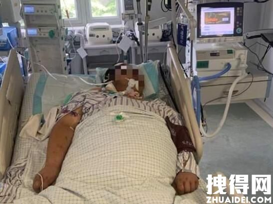 32岁快递员患热射病住进ICU 内幕曝光简直太意外了