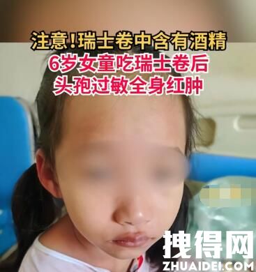 6岁女童吃瑞士卷引起头孢过敏 内幕曝光简直太意外了
