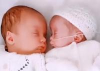 女子怀上双胞胎受孕时间相隔3周,宝宝体型差惊人:全球仅14例