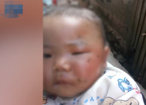 妇联回应5个月婴儿被打肿脸 内幕曝光简直太意外了