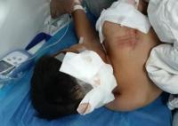 男童遭阿拉斯加犬咬伤 仍在ICU救治 内幕曝光简直太意外了